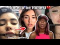 Madison Beer  FINALLY breaks her SILENCE and ADRESSES the CONTROVERSY surrounding her LOOKS