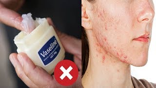 Celebrity Stop Using Vaseline Immediately! Here Why You Never Put Petroleum Jelly On Your Skin Net Worth