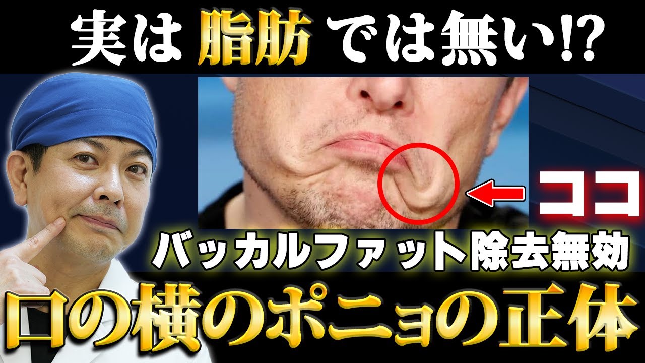 【口横のたるみ】イーロン・マスクで解説！口横のポニョの正体【実は脂肪ではなく〇〇】