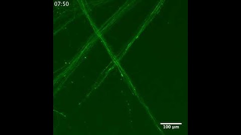 Axon Growth Cone in Organoid