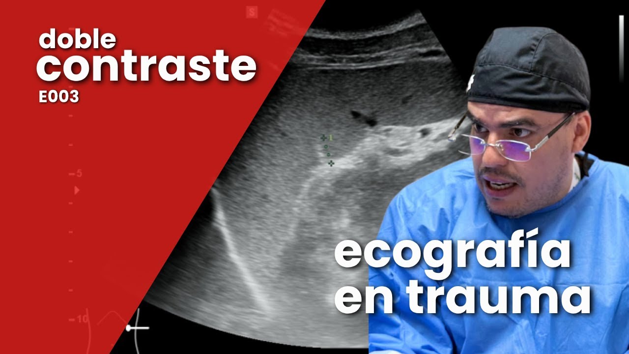 Doble Contraste - Ecografía en trauma | Episodio 3