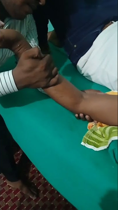 stiffness Elbow extension exercise post operative exercise