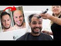 Balding men go bald for the first time compilation