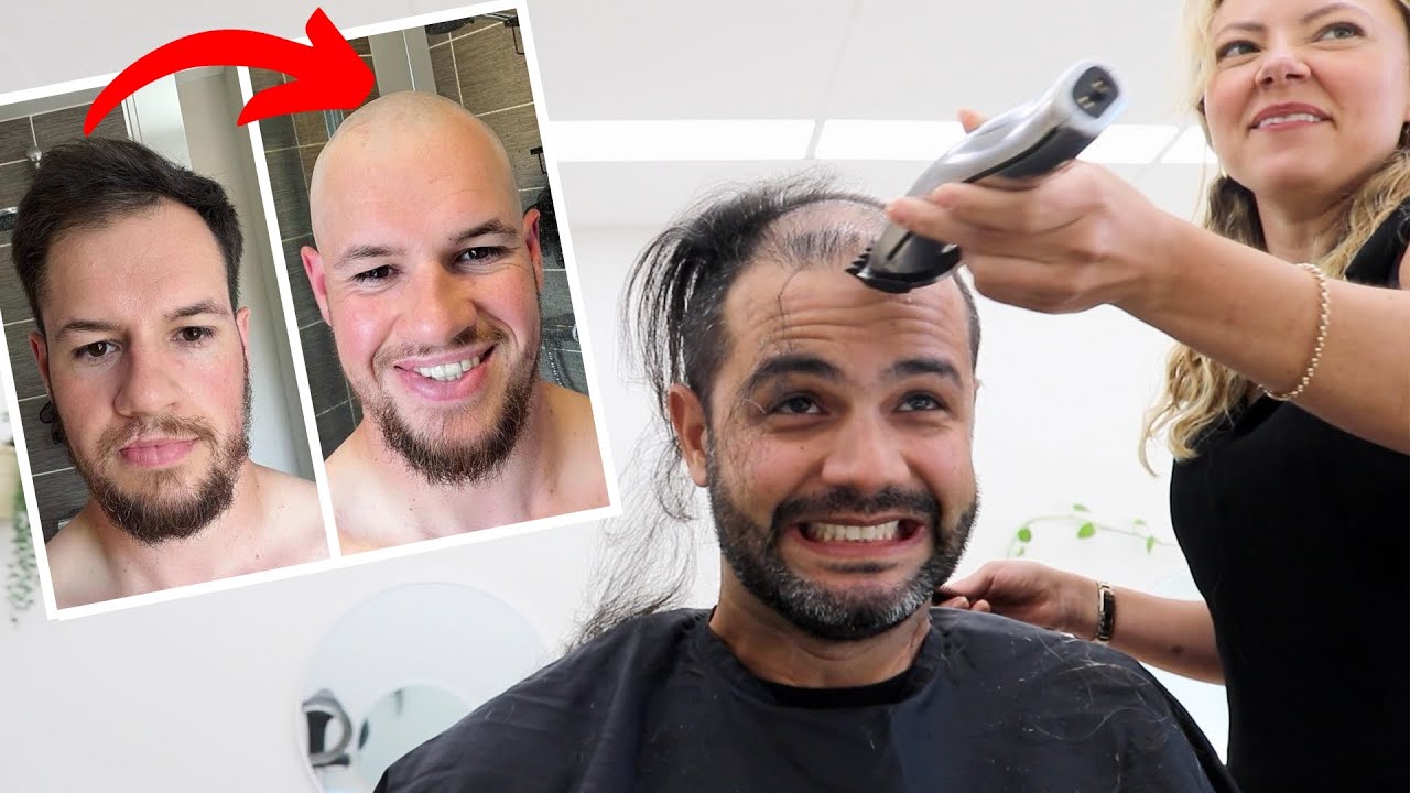 How I Lost All My Hair At 19
