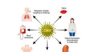 ماهو CMV الفيروس المضخم للخلايا أعراضه وكيفيه انتقاله