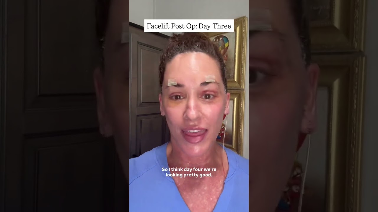 youtube-video-thumbnail