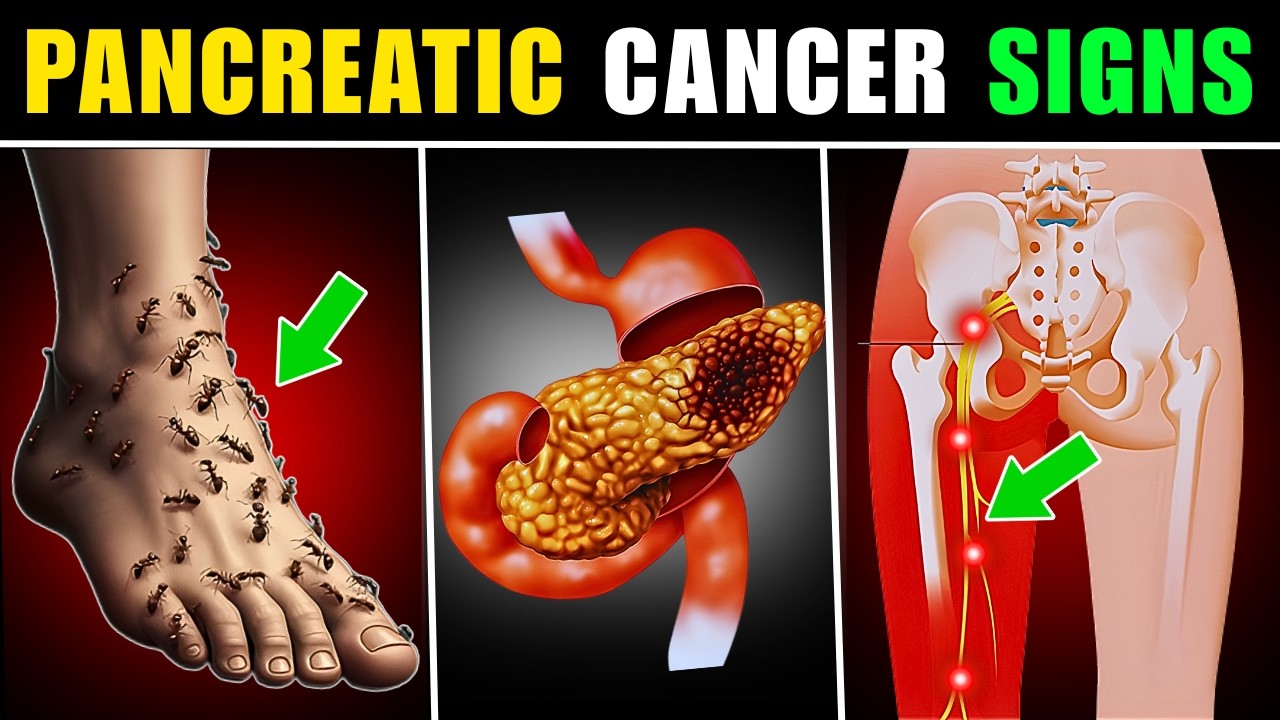 15 Silent Signs of Pancreatic Cancer You Must Need to Know - YouTube