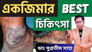 একজিমা হলে কি করবেন ? Nummular Dermatitis | Treatment | Bengali | Dr Supratim Saha screenshot 4