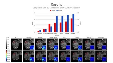 Compressed Sensing MRI Reconstruction with Co-VeGAN: Complex-Valued Generative Adversarial Network
