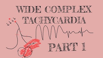 Wide complex tachycardia - Part 1