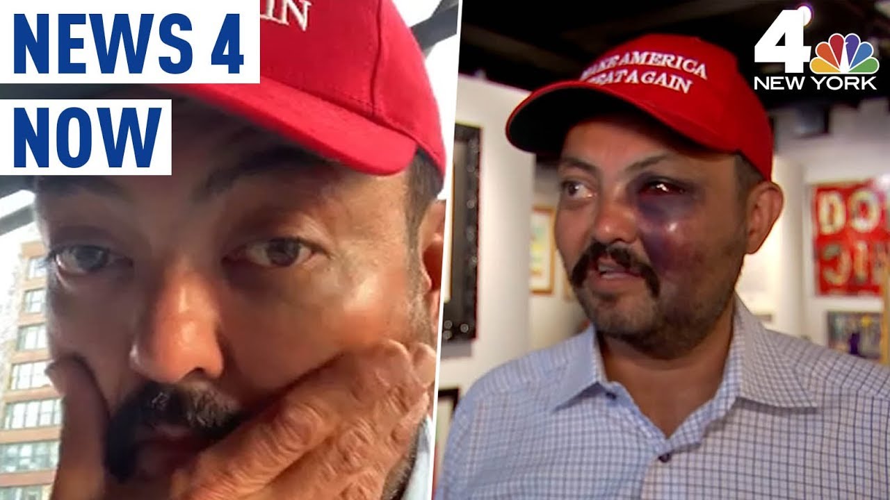 Maga Hat Attack Police Looking For Mob That Beat Man Over Trump Support News 4 Now Youtube