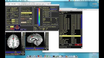 AFNI Command of the Week: 3dROIstats