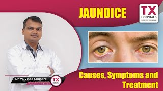 Jaundice : Causes, Symptoms, and Treatment || Best @gastroenterologist in #hyderabad || TX Hospitals