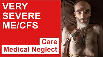 Very Severe ME/CFS