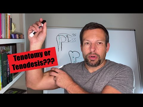 Video: De ce să faci o tenotomie a bicepsului?