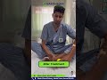 From Treatment to Recovery | Real Patient Review at Vardhman Hospital #vardhmanhospital #doctor