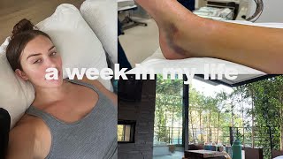 VLOG ★ life updates!! i moved + how i broke my ankle