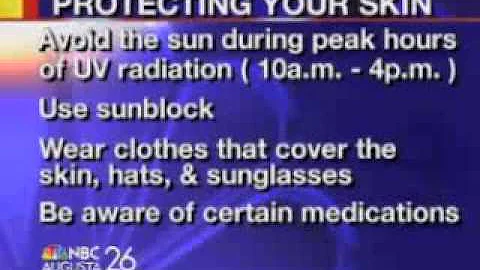 Sunburns by Nancy Raborn