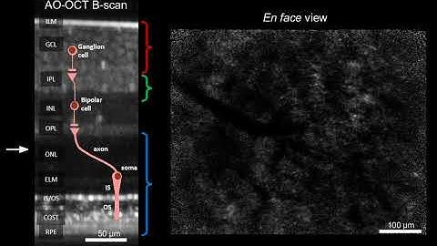 Cellular Scale Imaging of Transparent Retinal Structures and Processes: Supplemental Video 2