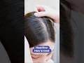 Head lice: How to treat