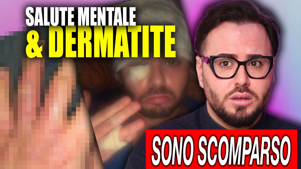 SONO SCOMPARSO. dermatite, burnout e imprevisti | CharlieO