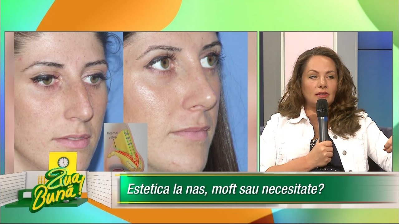 interventionist คือ Estetica la nas, moft sau necesitate?