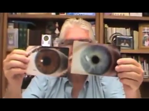 الفرق بين العين البنيه الأصل و الزرقاء د روبرت مورس