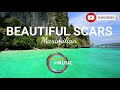 Beautiful scars by maximilian lovelife music soundtrack