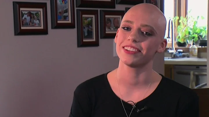 Osseo H.S. Student Doesn't Let Hair Loss Disease Define Her