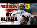 REGROW HAIR BY CUPPING  | PART-1 | HINDI | ANI RAY