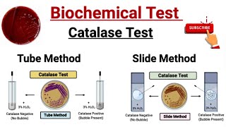 Biochemical Test For identification of Bacteria || Catalase Test || Test Tube Method ||Slide Method