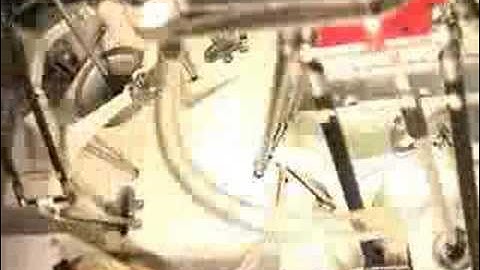 20th birthday of the Delta Robot