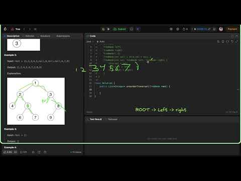 Binary Tree Preorder Traversal Iterative   Leetcode 144   Java