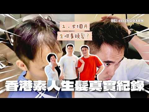 【震驚】香港素人生髮真實紀錄！1.5個月頭髮已暴增？當事人都有被嚇倒？Ling姐爆firm：兩個半月可以令佢頭髮返哂嚟！