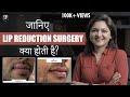 Lip Reduction Surgery in India | सर्जरी करवाने से पहले ज़रूर देखें ये वीडियो