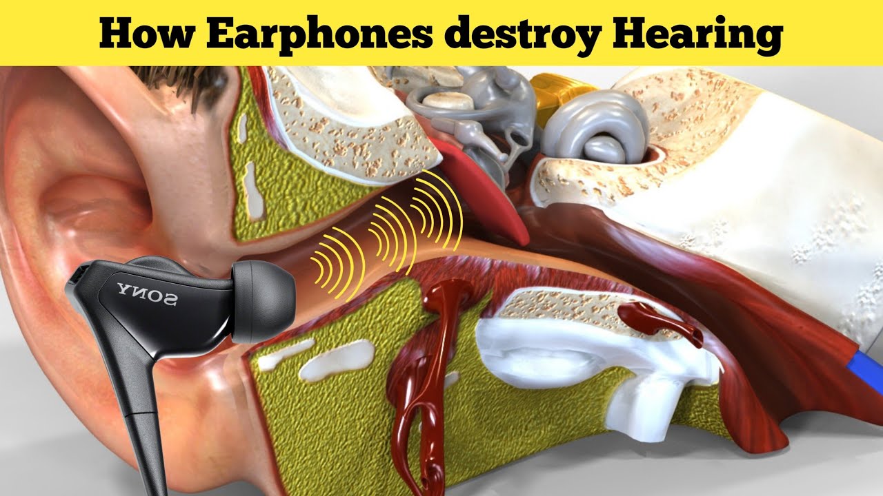 noise induced hearing loss how earphones damage hearing YouTube