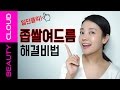 ENG) 특집! 지겨운 좁쌀여드름 안녕~! 화이트헤드 없애기  Una’s millet seed acne treatment!  - U:NA BEAUTY CLOUD #59