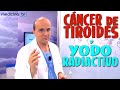 CÁNCER DE TIROIDES y YODO RADIACTIVO ¿Para qué se usa? - Cáncer #41