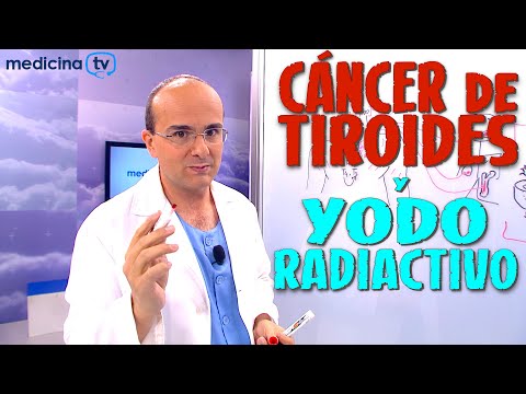 CÁNCER DE TIROIDES y YODO RADIACTIVO ¿Para qué se usa? - Cáncer #41