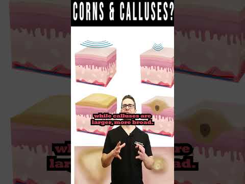 Video: Kaip salicilo rūgštis veikia kukurūzus?