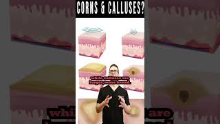 Foot CORNS & CALLUSES: How To Get Rid Of Them For Good! screenshot 5