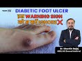 Daily Foot Care to Avoid Diabetic Foot Ulcers