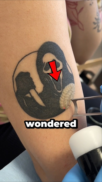How Tattoo Removal Works 😯