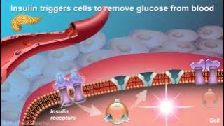 Download lagu Understanding Type 2 Diabetes