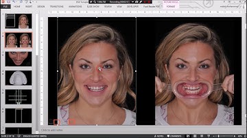 Digital Smile Design DSD using Microsoft PowerPoint - Full protocol