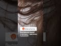 Выпадение волос у женщин – причины и решения