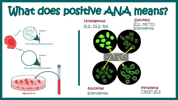 Antinuclear Antibodies (ANA) test and their patter...