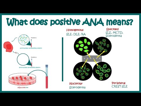 Antinuclear Antibodies (ANA) test and their patterns | ANA test | What does ANA test positive mean?