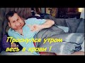 Проснулся утром весь в крови !