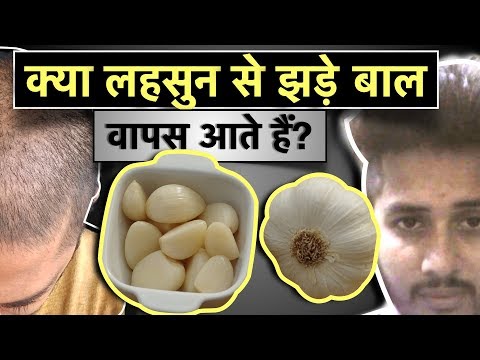 如何使頭髮長得快? hqdefault